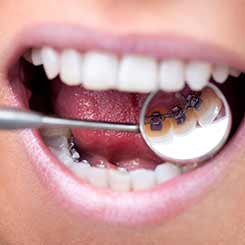 Orthodontist-in-Hitchin